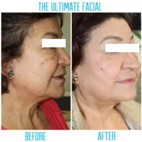 Bild von The Ultimate Facial