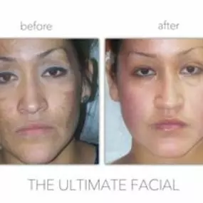 Bild von The Ultimate Facial