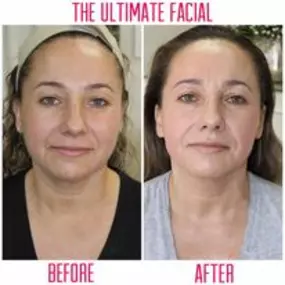 Bild von The Ultimate Facial