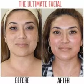 Bild von The Ultimate Facial