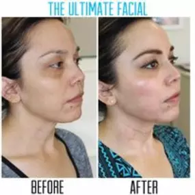 Bild von The Ultimate Facial