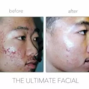 Bild von The Ultimate Facial