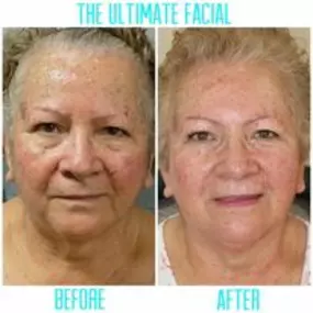 Bild von The Ultimate Facial