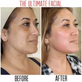 Bild von The Ultimate Facial