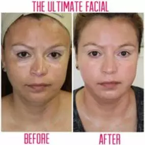 Bild von The Ultimate Facial