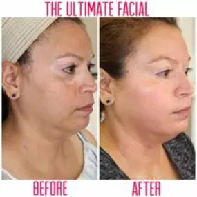 Bild von The Ultimate Facial