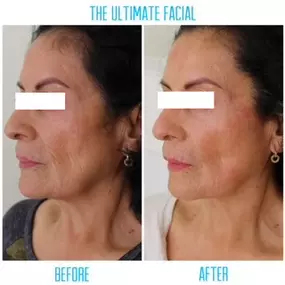 Bild von The Ultimate Facial