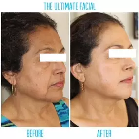 Bild von The Ultimate Facial