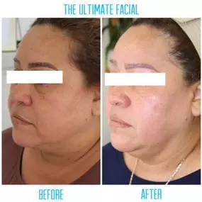 Bild von The Ultimate Facial