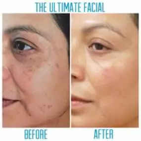 Bild von The Ultimate Facial