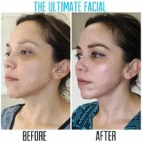 Bild von The Ultimate Facial