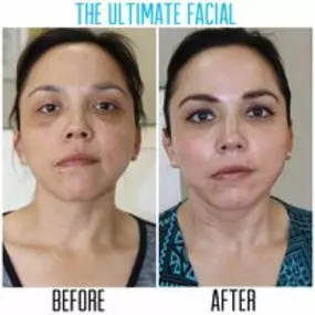 Bild von The Ultimate Facial