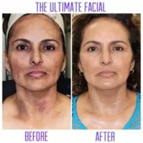 Bild von The Ultimate Facial