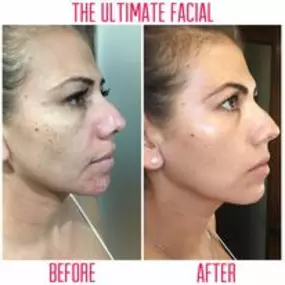 Bild von The Ultimate Facial