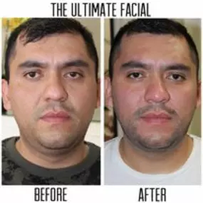 Bild von The Ultimate Facial