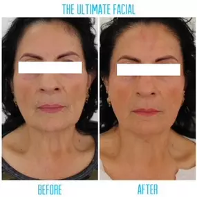 Bild von The Ultimate Facial