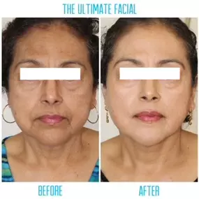 Bild von The Ultimate Facial