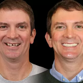 Bild von Birmingham Dental Implant Studio