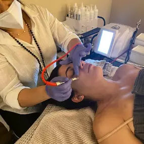 Avani Skin Care - Jet plasma collagen induction therapy