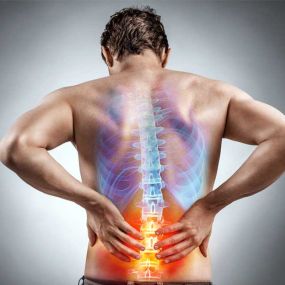 Sciatica pain