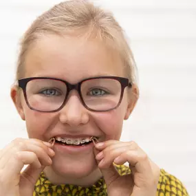 Orthodontie bij jonge kinderen
In sommige gevallen wordt er reeds vroegtijdig, voor de leeftijd van 9 jaar gestart met orthodontie:

De bovenkaak is veel te smal en er is te weinig plaats voor de tanden om door te breken.
Zijdelings staan de boventanden aan de binnenkant van de ondertanden. Dit is een kruisbeet.
De ondertanden komen voor de boventanden bij het dichtbijten. Dit noemt men een klasse III.
De onderkaak staat scheef ten opzichte van de bovenkaak bij het dichtbijten. Je hebt een kruis