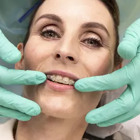 OrthodontieSchreurs staat garant voor de nieuwste behandelingstechnieken binnen de orthodontie, om voor iedere patiënt het beste resultaat te bieden.

Rechte tanden en een goede kaakrelatie zorgen ervoor dat je goed kunt bijten, kauwen, praten, poetsen en lachen.

Orthodontie is meer dan alleen het rechtzetten van tanden. Een goede relatie tussen je kaken en tanden is belangrijk voor een optimaal functioneel en esthetisch resultaat.

Een goed passend gebit is belangrijk voor behoud van je tanden