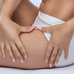 Cellulite Behandlung