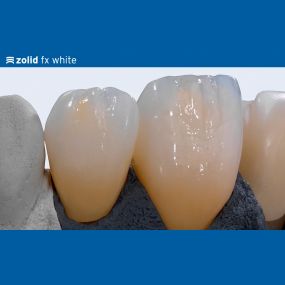 Zirkonkronen | Ritter Dentallabor | München-Obergiesing