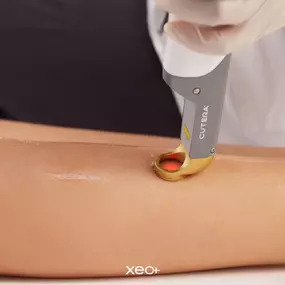 Painless Laser Hair Removal | The Skin Suite Lexington KY