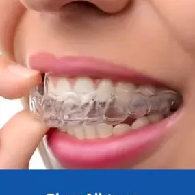 Bild von Dental Implants Veneers