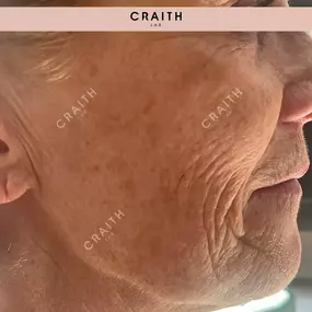 Bild von Diana Birke - Praxis für Kosmetik