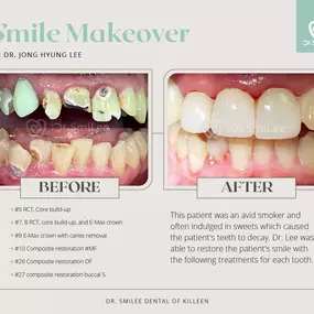 ​Dr. SmiLee Dental of Killeen Dental Implant, Family, Cosmetic, Emergency, IV Sedation, Braces, Facial Esthetics  | Address: 1001 S Fort Hood St Ste 1001 B, Killeen, TX 76541 | Call: 254-342-3292