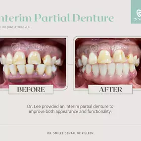 Dr. SmiLee Dental of Killeen Dental Implant, Family, Cosmetic, Emergency, IV Sedation, Braces, Facial Esthetics  | Address: 1001 S Fort Hood St Ste 1001 B, Killeen, TX 76541 | Call: 254-342-3292