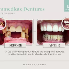 Dr. SmiLee Dental of Killeen Dental Implant, Family, Cosmetic, Emergency, IV Sedation, Braces, Facial Esthetics  | Address: 1001 S Fort Hood St Ste 1001 B, Killeen, TX 76541 | Call: 254-342-3292