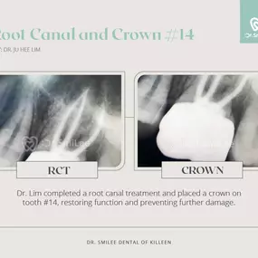 Dr. SmiLee Dental of Killeen Dental Implant, Family, Cosmetic, Emergency, IV Sedation, Braces, Facial Esthetics  | Address: 1001 S Fort Hood St Ste 1001 B, Killeen, TX 76541 | Call: 254-342-3292