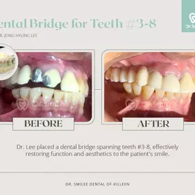 Dr. SmiLee Dental of Killeen Dental Implant, Family, Cosmetic, Emergency, IV Sedation, Braces, Facial Esthetics  | Address: 1001 S Fort Hood St Ste 1001 B, Killeen, TX 76541 | Call: 254-342-3292