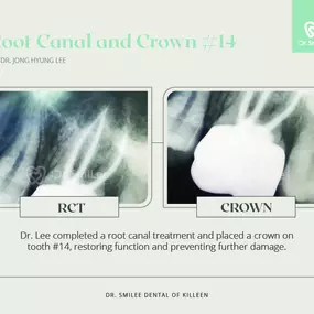 ​Dr. SmiLee Dental of Killeen Dental Implant, Family, Cosmetic, Emergency, IV Sedation, Braces, Facial Esthetics  | Address: 1001 S Fort Hood St Ste 1001 B, Killeen, TX 76541 | Call: 254-342-3292