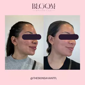 Bild von Bloom Aesthetics