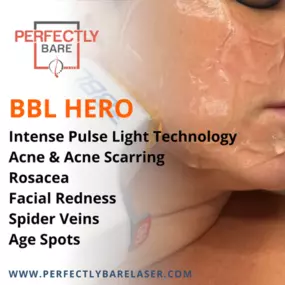 Bild von Perfectly Bare Laser