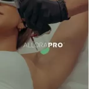 AlloraPRO Laser Hair Removal/Skin Revitalization