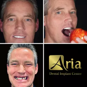 Bild von Aria Dental Implant Center