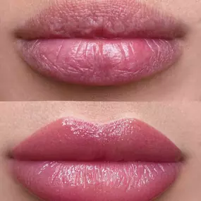 MICRO-LABIOS-USERA-MADRID.jpg