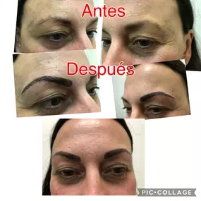 MICRO-CEJAS-LA-LATINA-MADRID.jpg