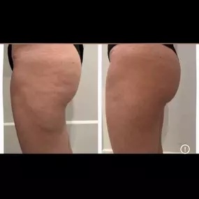 Bild von Body Lounge Park Cities - Whole Body Wellness & Medical Aesthetics, Dallas, TX
