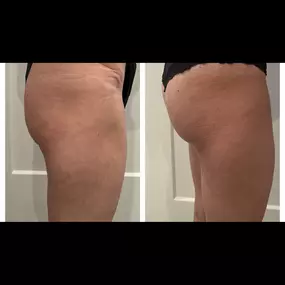 Bild von Body Lounge Park Cities - Whole Body Wellness & Medical Aesthetics, Dallas, TX
