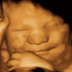 Bild von Mommy2Bee 4D Ultrasound