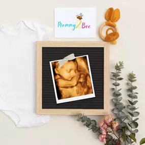 Bild von Mommy2Bee 4D Ultrasound