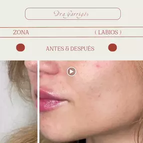 Bild von Clínica de Medicina Estética y Bienestar en Longevity by Dra.Eva Garrigós