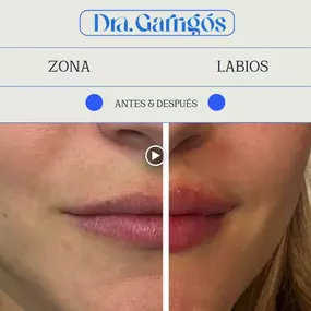 Bild von Clínica de Medicina Estética y Bienestar en Longevity by Dra.Eva Garrigós