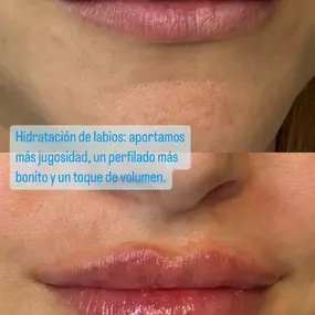 Bild von Clínica de Medicina Estética y Bienestar en Longevity by Dra.Eva Garrigós